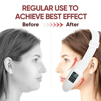 SwayLine™ Jaw Sculptor